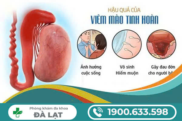 Hình ảnh minh họa